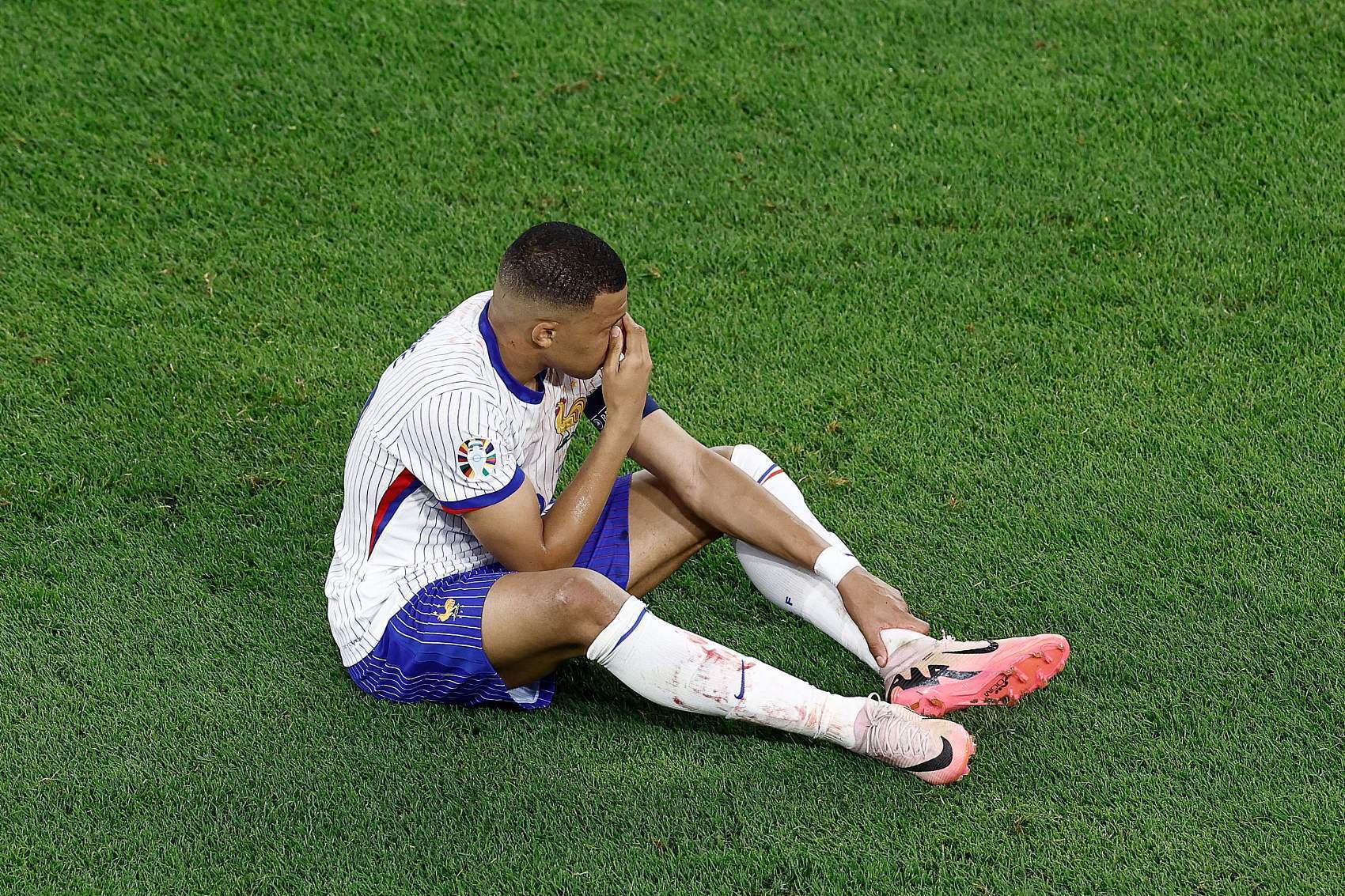 【欧洲杯】姆巴佩鼻梁骨折，法国险胜奥地利