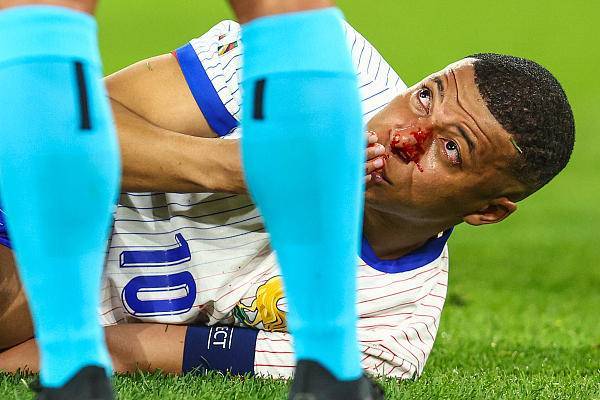 干杯欧罗巴 | 欧洲杯仍未破“蛋” 受伤的姆巴佩变身“面具侠”？